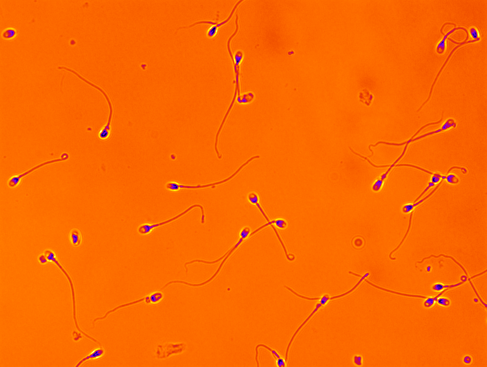 Microscopic image of sperm cells